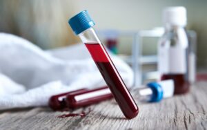 Prima della nascita, un esame del sangue potrebbe rivelare il rischio di depressione post-partum, rivela uno studio