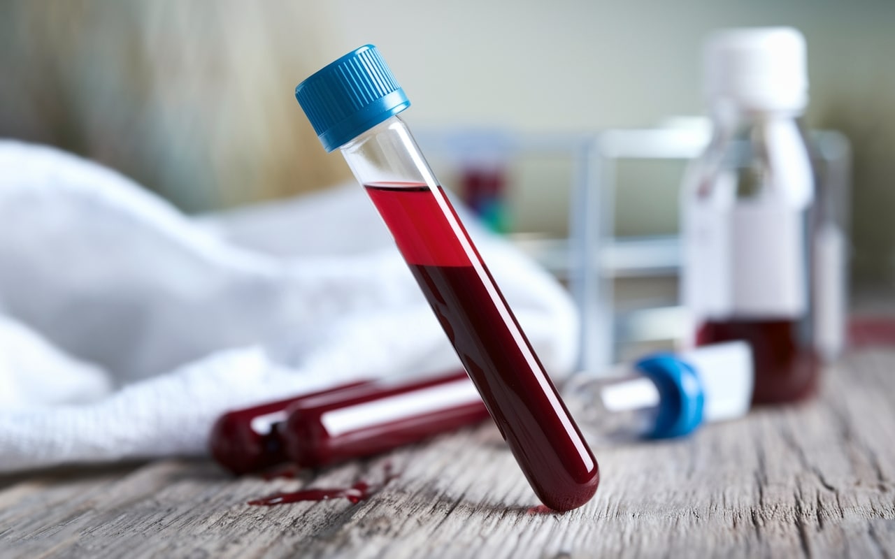 Prima della nascita, un esame del sangue potrebbe rivelare il rischio di depressione post-partum, rivela uno studio